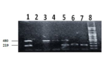 Age- and gender-independent association of glutathione S-transferase null polymorphisms with chronic myeloid leukemia