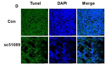 EP1 receptor is involved in prostaglandin E2-induced osteosarcoma growth