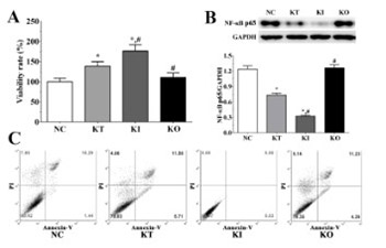 Ketamine exerts a protective role in a cell-based model of major depressive disorder via the inhibition of apoptosis and inflammation and activation of the Krebs cycle