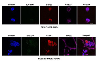 Role of FBXW7 in the quiescence of gefitinib-resistant lung cancer stem cells in EGFR-mutant non-small cell lung cancer