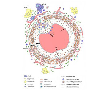 Pathogenesis of atherosclerosis in the tunica intima, media, and adventitia of coronary arteries: An updated review