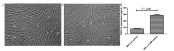 Mesenchymal stem cells from bone marrow regulate invasion and drug resistance of multiple myeloma cells by secreting chemokine CXCL13