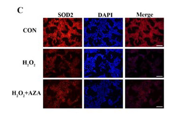 Effect of SOD2 methylation on mitochondrial DNA4834-bp deletion mutation in marginal cells under oxidative stress