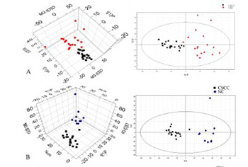 Tissue-based metabolomics reveals potential biomarkers for cervical carcinoma and HPV infection