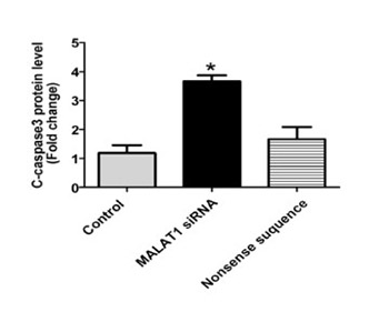 MALAT1 inhibits the Wnt/β-catenin signaling pathway in colon cancer cells and affects cell proliferation and apoptosis