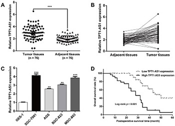 Knockdown of TPT1-AS1 inhibits cell proliferation, cell cycle G1/S transition, and epithelial–mesenchymal transition in gastric cancer