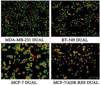 WD-3 inhibits the proliferation of breast cancer cells by regulating the glycolytic pathway