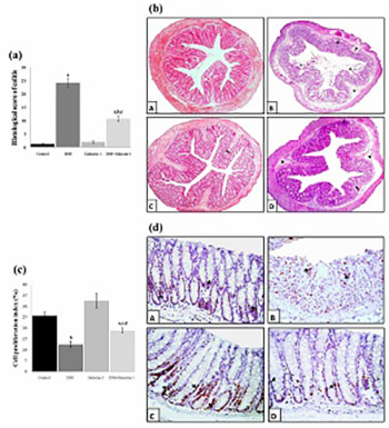 Galectin-1 reduces the severity of dextran sulfate sodium (DSS)-induced ulcerative colitis by suppressing inflammatory and oxidative stress response