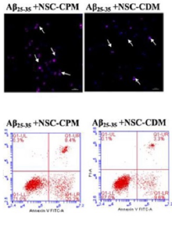 Neural stem cell-conditioned medium ameliorates Aβ25–35-induced damage in SH-SY5Y cells by protecting mitochondrial function