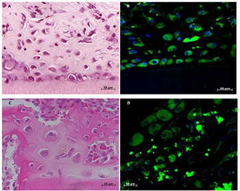 Immunohistochemical study of dental pulp cells with 3D collagen type I gel in demineralized dentin tubules in vivo