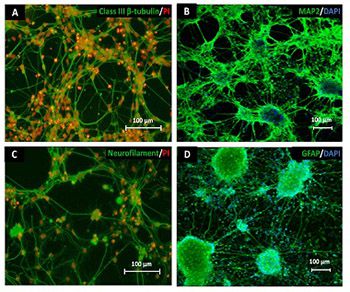 Asymptomatic neurotoxicity of amyloid β-peptides (Aβ1-42 and Aβ25-35) on mouse embryonic stem cell-derived neural cells