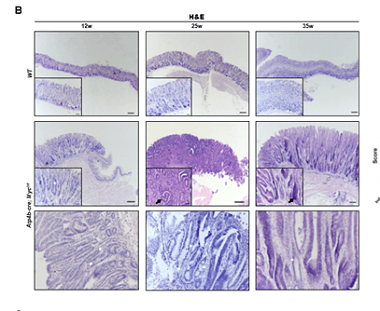 Stomach-specific c-Myc overexpression drives gastric adenoma in mice via AKT/mTOR signaling