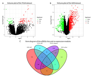 Bioinformatics analysis reveals TSPAN1 as a candidate biomarker of progression and prognosis in pancreatic cancer