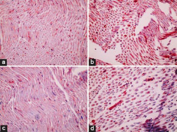 Different dose-dependent effects of ebselen in sciatic nerve ischemia-reperfusion injury in rats