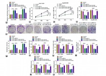 Circ-RNF13, as an oncogene, regulates malignant progression of HBV-associated hepatocellular carcinoma cells and HBV expression and replication through circ-RNF13/miR-424-5p/TGIF2 ceRNA pathway