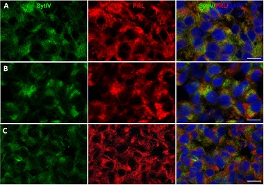 Effects of L-dopa on expression of prolactin and synaptotagmin IV in 17-estradiol-induced prolactinomas of ovariectomized hemiparkinsonian rats