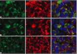 Effects of L-dopa on expression of prolactin and synaptotagmin IV in 17-estradiol-induced prolactinomas of ovariectomized hemiparkinsonian rats