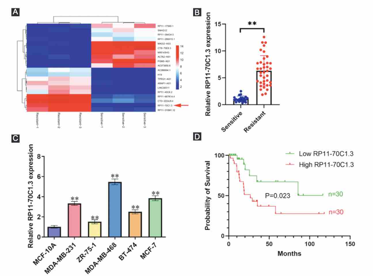 Long noncoding RNA RP11-70C1.3 confers chemoresistance of breast cancer cells through miR-6736-3p/NRP-1 axis