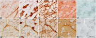 Skeletal muscle and fiber type-specific intramyocellular lipid accumulation in obese mice