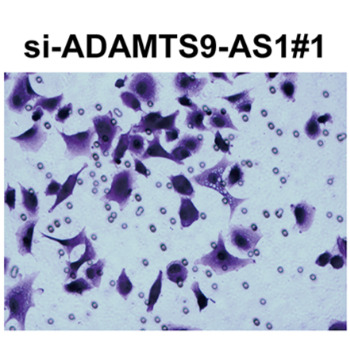 LncRNA ADAMTS9-AS1 knockdown suppresses cell proliferation and migration in glioma via down-regulating Wnt/β-catenin signaling pathway