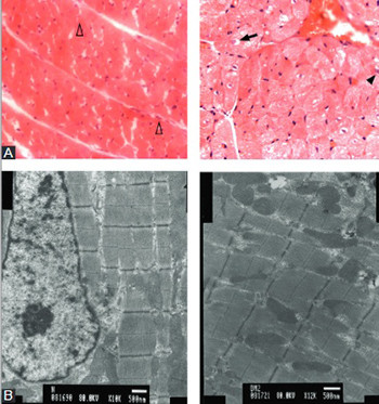 Effect and mechanisms of zinc supplementation in protecting against diabetic cardiomyopathy in a rat model of type 2 diabetes
