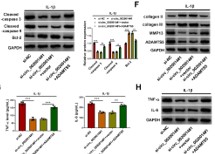 Circular RNA circ_0020014 contributes to osteoarthritis progression via miR-613/ADAMTS5 axis