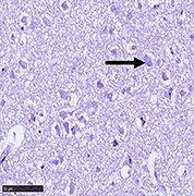 Tenofovir-silver nanoparticles conjugate ameliorates neurocognitive disorders and protects ultrastructural and cytoarchitectonic properties of the prefrontal cortex  in diabetic rats