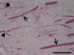 Comparison of the vitality tests used in the dental clinical practice and histological analysis of the dental pulp