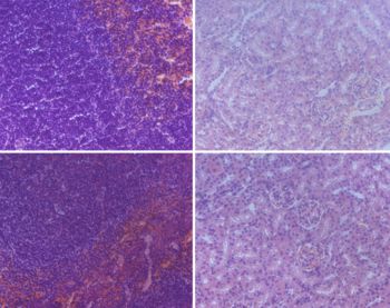 Reactive oxygen species activated by mitochondria-specific camptothecin prodrug for enhanced chemotherapy