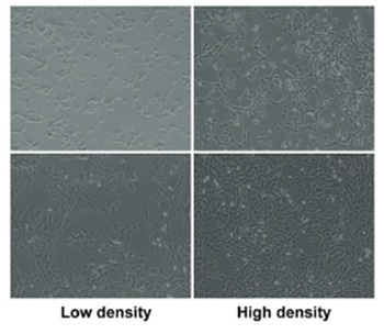 Huaiqihuang may protect from proteinuria by resisting MPC5 podocyte damage via targeting p-ERK/CHOP pathway