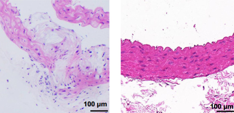 D-box-binding protein alleviates vascular calcification in rats with chronic kidney disease by activating microRNA-195-5p and downregulating cyclin D1