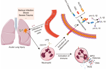The link between neutrophils, NETs, and NLRP3 inflammasomes: The dual effect of CD177 and its therapeutic potential in ARDS/ALI