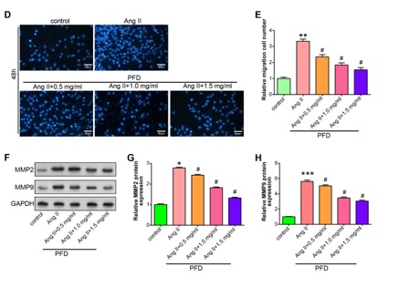 PARP9 affects myocardial function through TGF-β/Smad axis and pirfenidone