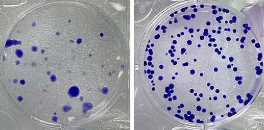 Role and mechanism of KIAA1429 in regulating cellular ferroptosis and radioresistance in colorectal cancer