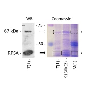 Reconsideration of the laminin receptor 67LR in colorectal cancer cells