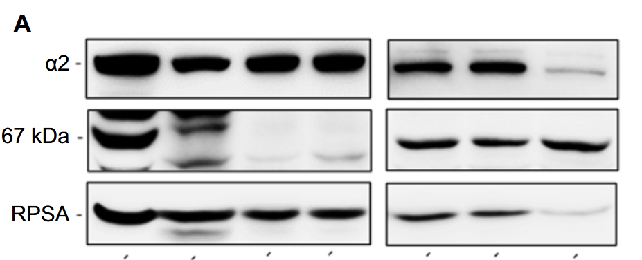 Reconsideration of the laminin receptor 67LR in colorectal cancer cells