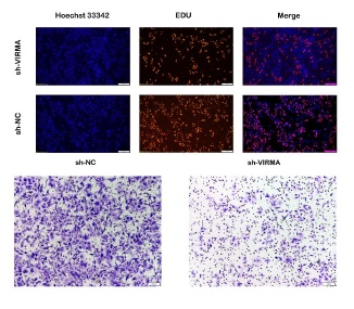 VIRMA promotes the progression of head and neck squamous cell carcinoma by regulating UBR5 mRNA and m6A levels