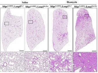 Aging of alveolar type 2 cells induced by Lonp1 deficiency exacerbates pulmonary fibrosis