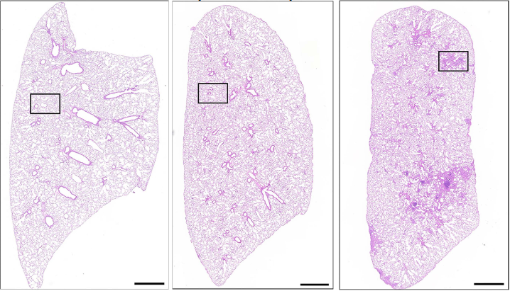 Aging of alveolar type 2 cells induced by Lonp1 deficiency exacerbates pulmonary fibrosis