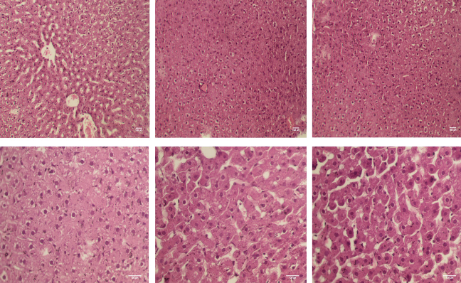 lncRNA CASC7 contributes to the progression of LPS-induced liver injury by targeting miRNA-217/TLR4 axis