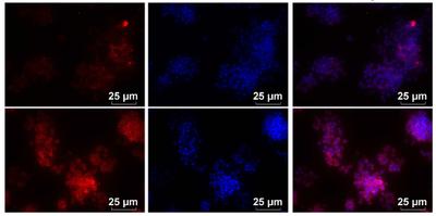 hUC-MSC extracellular vesicles protect against hypoxic-ischemic brain injury by promoting NLRP3 ubiquitination