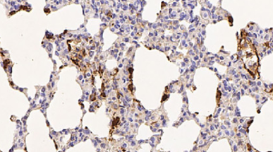 Inhibition of RUNX1 slows the progression of pulmonary hypertension by targeting CBX5