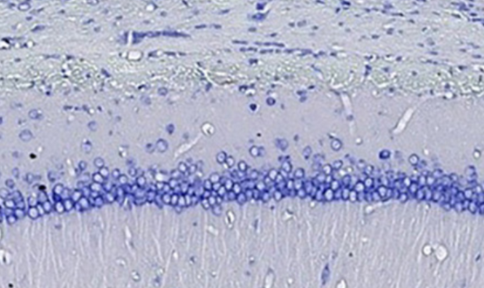 Nogo-A exacerbates sepsis-associated encephalopathy by modulating microglial SHP-2/NLRP3 balance and inducing ROS and M1 polarization