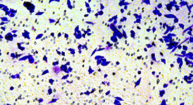 Botulinum toxin type A inhibits the formation of hypertrophic scar through the JAK2/STAT3 pathway