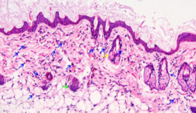 Total glucosides of paeony inhibit NLRP3/caspase-1/GSDMD-mediated inflammation and pyroptosis in C3H/HeJ alopecia areata mice