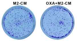 Periplocin improves the sensitivity of oxaliplatin-resistant hepatocellular carcinoma cells by inhibiting M2 macrophage polarization