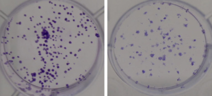 Hsa_circ_0023179 modulated the processes of proliferation, apoptosis, and EMT in non-small cell lung cancer cells via the miR-615-5p/CDH3 axis