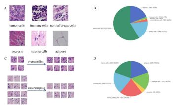 Detecting cell types and densities in the tumor microenvironment improves prognostic risk assessment for breast cancer