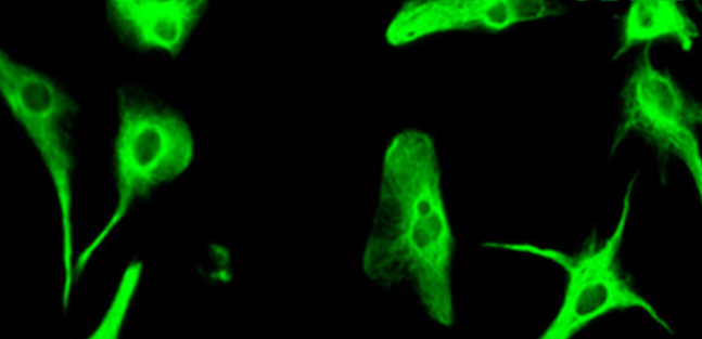 Effect of β-1,4-GalTI on the biological function of astrocytes treated by LPS