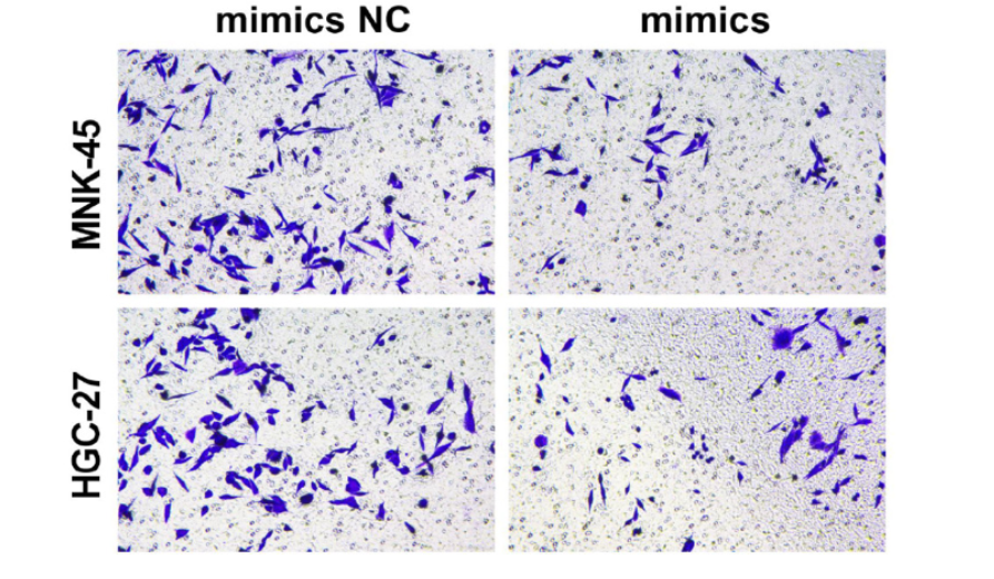 MiR-509-3p promotes gastric cancer development by activating FOXM1-mediated p38/MK2 pathway